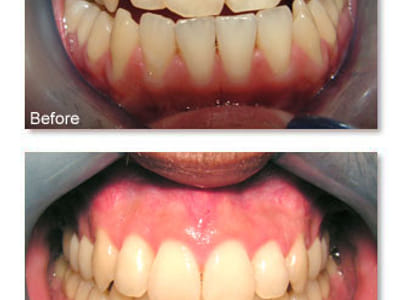 Alhambra Dentist - The Perfect Smile