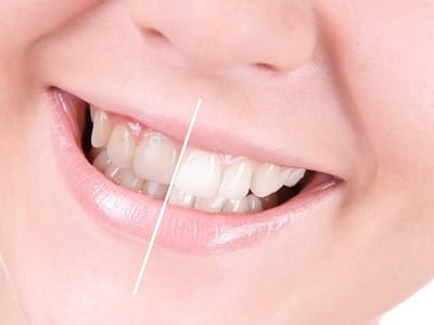 All Smiles Dentistry