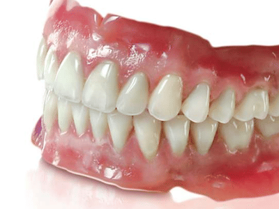All Smiles Family Dentistry - Dentures, Extractions, Dental Implants, Quick Dentures