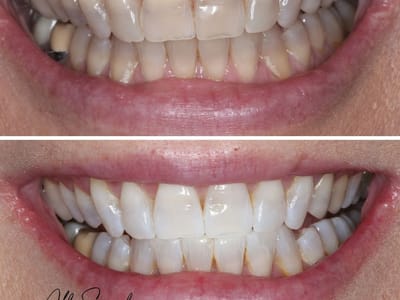 All Smiles Family Dentistry