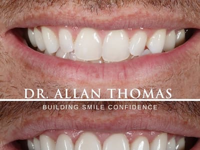 Allan S. Thomas, DMD - Cosmetic and General Dentistry