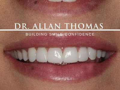 Allan S. Thomas, DMD - Cosmetic and General Dentistry