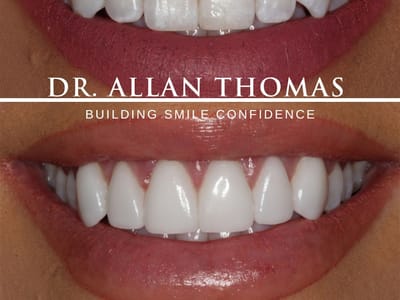 Allan S. Thomas, DMD - Cosmetic and General Dentistry