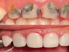 Amarillo Pediatric Dentistry and Orthodontics