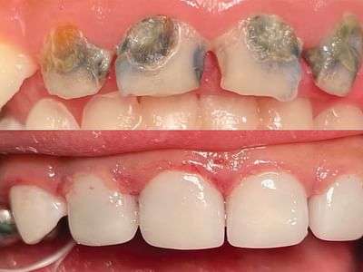 Amarillo Pediatric Dentistry and Orthodontics