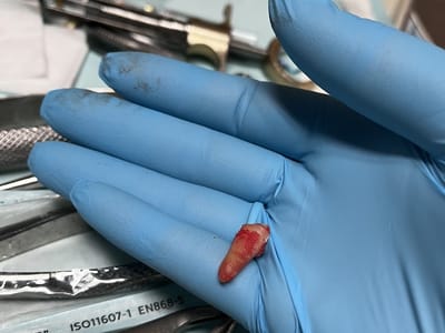 Anaheim Dentist - Open 7 Days A Week - Until Midnight