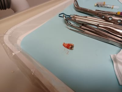 Anaheim Dentist - Open 7 Days A Week - Until Midnight