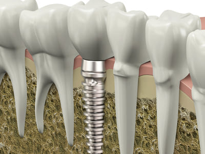 Anchorage Midtown Dental Center