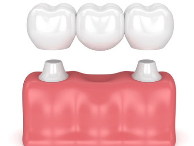 Appletree Family Dental