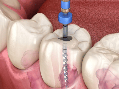 Appletree Family Dental