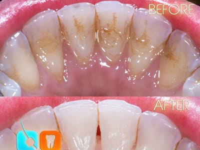 Arguello Dentistry Lauderdale-by-the-Sea