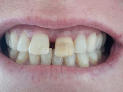 Arkansas Dental Centers - East Oak