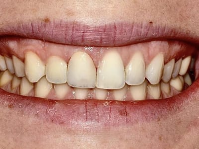 Art of Cosmetic Dentistry