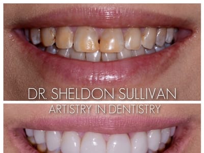 Artistry in Dentistry