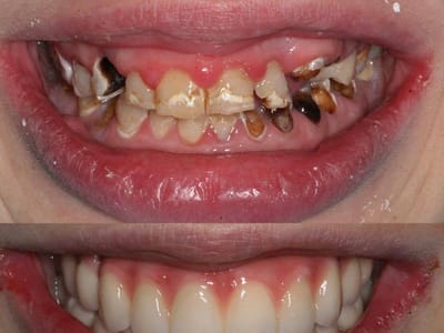 Ascension Premier Dental