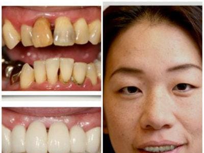 Aspen Ridge Dental Care