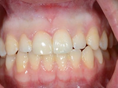 Atencio Dentistry of Reno NV