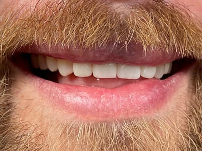 Avenues Dentistry Salt Lake City