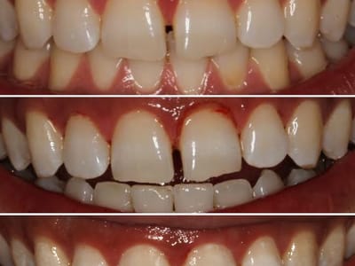 Beautiful Smiles Dentistry