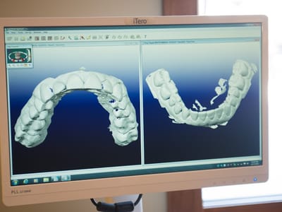 Bennion Lambourne Orthodontics