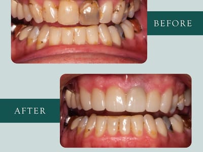 Billings West Dental