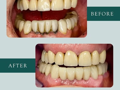 Billings West Dental