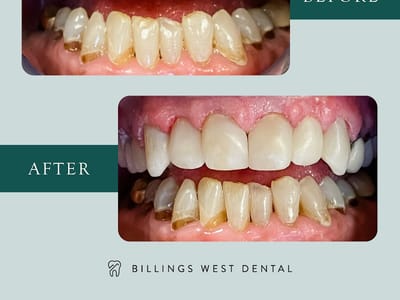 Billings West Dental