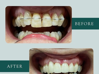 Billings West Dental