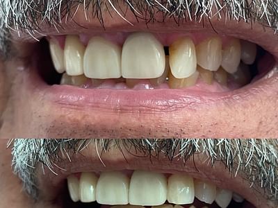 Blatchley Family Dentistry: Ryan T. Blatchley, DDS