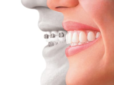 Bliss Dental & Orthodontics East Odessa