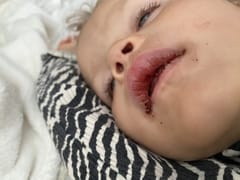 Bloomington Courtyard Dental: Ashton A Prince, DMD