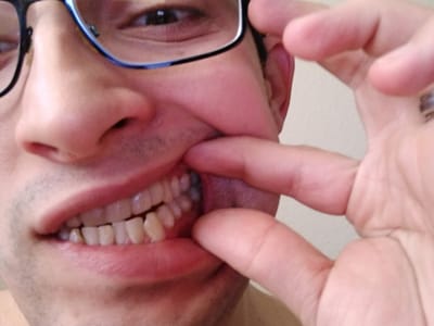 Bloomington Courtyard Dental: Ashton A Prince, DMD