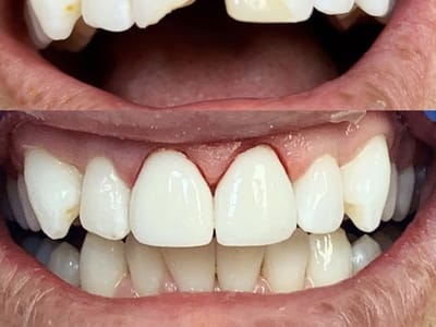 Bloomington Dental— Chris A. Neilson DDS