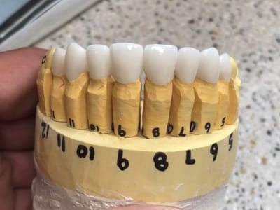 Bloomington Dental— Chris A. Neilson DDS