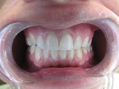 Bluffdale Dental - Dr. David Babcock