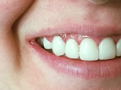 BLVD Dentistry & Orthodontics- Riverside