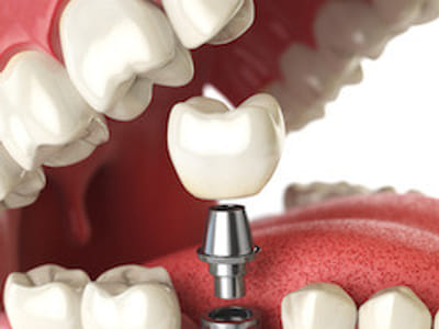 Boise Dentistry Co. - 5 Mile