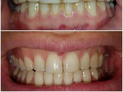 Bral Dentistry: General, Implant & Emergency Care