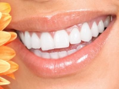 Bright Smile Dentistry- Dr Rassam-Zora