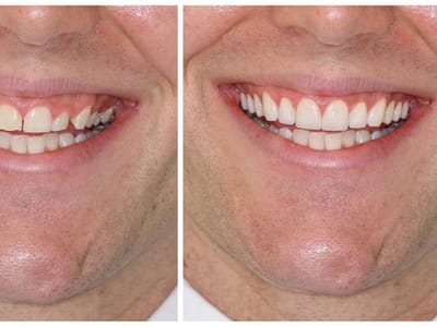 Bright Smile Dentistry- Dr Rassam-Zora