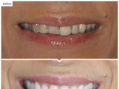 Bright Smile Dentistry- Dr Rassam-Zora