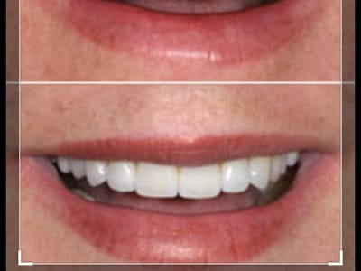 Bright Smile Dentistry- Dr Rassam-Zora