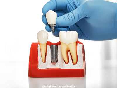 Bright Smiles Dentistry