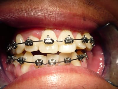 Brunswick Dental Associates-Dentista Hispana en New Brunswick- Dentist New Brunswick