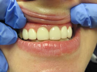 Brunswick Dental Associates-Dentista Hispana en New Brunswick- Dentist New Brunswick