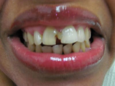 Brunswick Dental Associates-Dentista Hispana en New Brunswick- Dentist New Brunswick