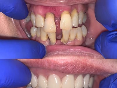 Brushy Creek Dentistry