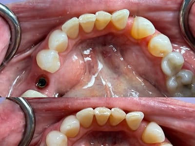 Buffalo General Dentistry | Implant, Sedation & Cosmetic