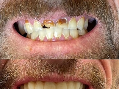 Buffalo General Dentistry | Implant, Sedation & Cosmetic