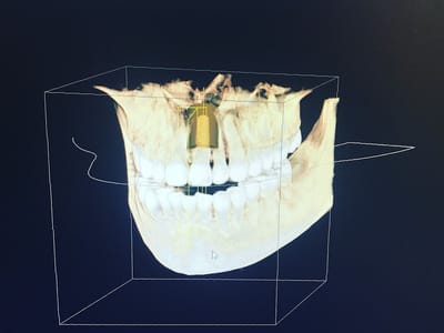 Burgin Dentistry I Jeremy Burgin D.D.S. PC